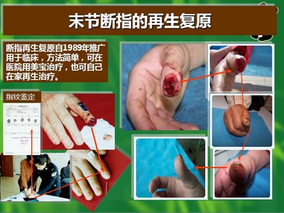 Ggpoker官网-不凡成就非凡,相信品牌的力量